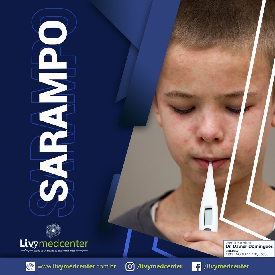 SARAMPO