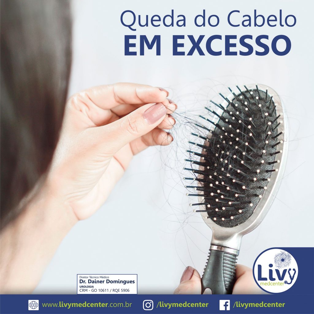 Queda do Cabelo em Excesso