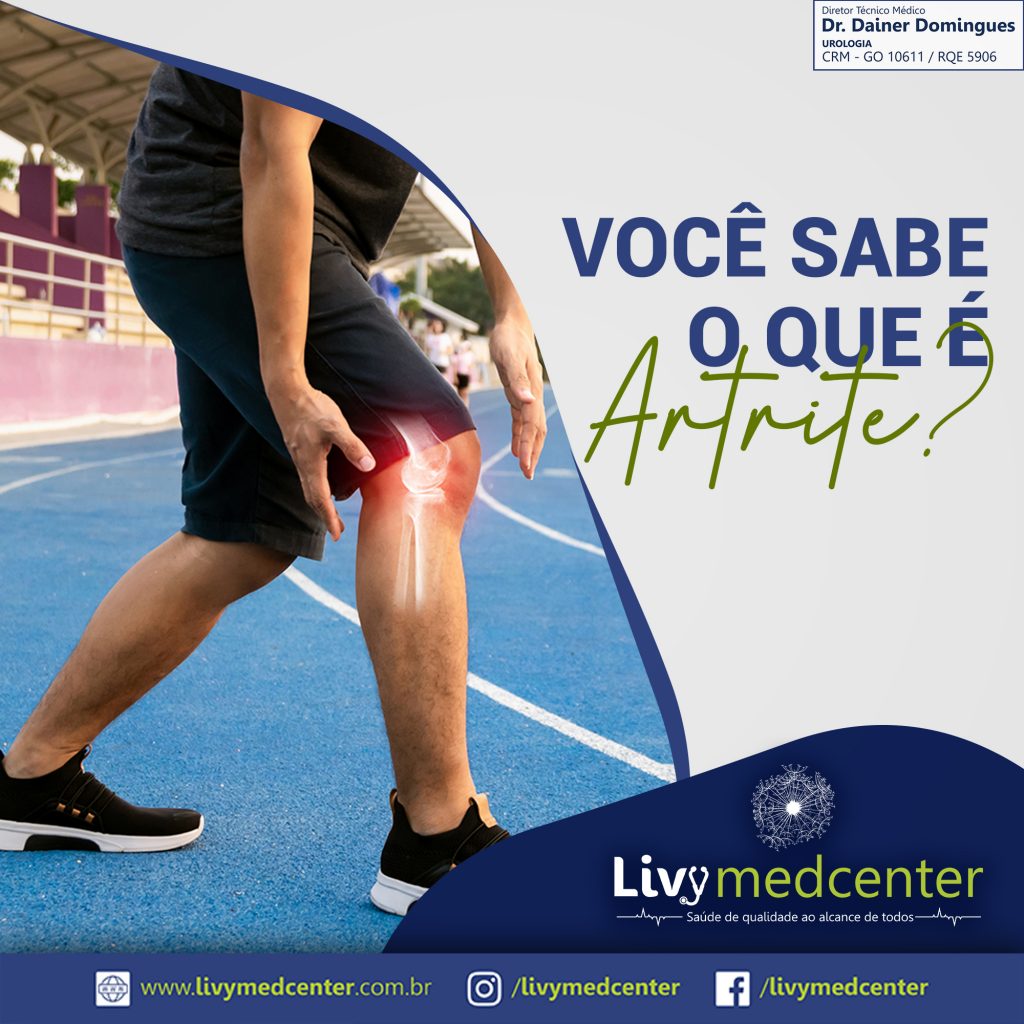 O que é Artrite?