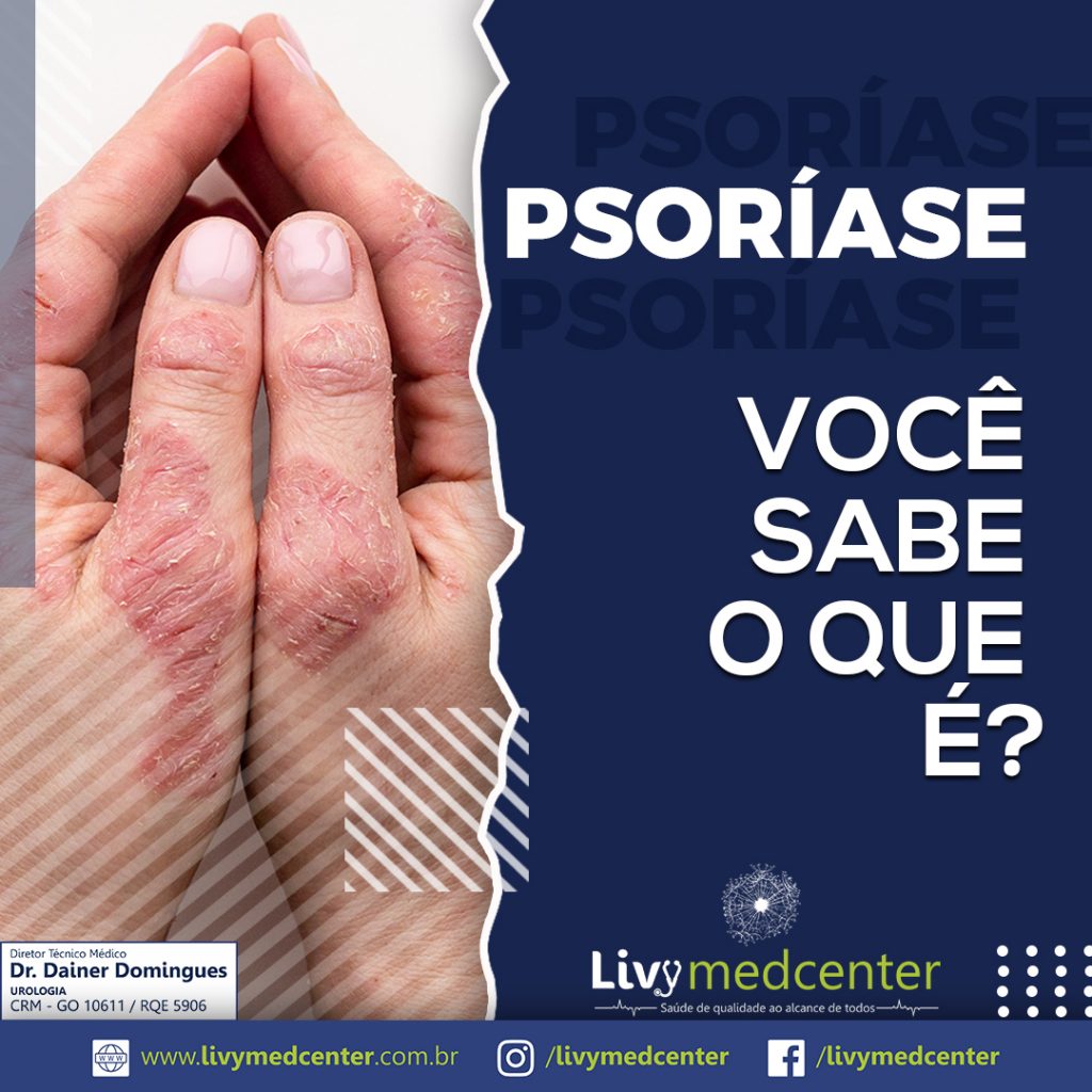 Psoríase
