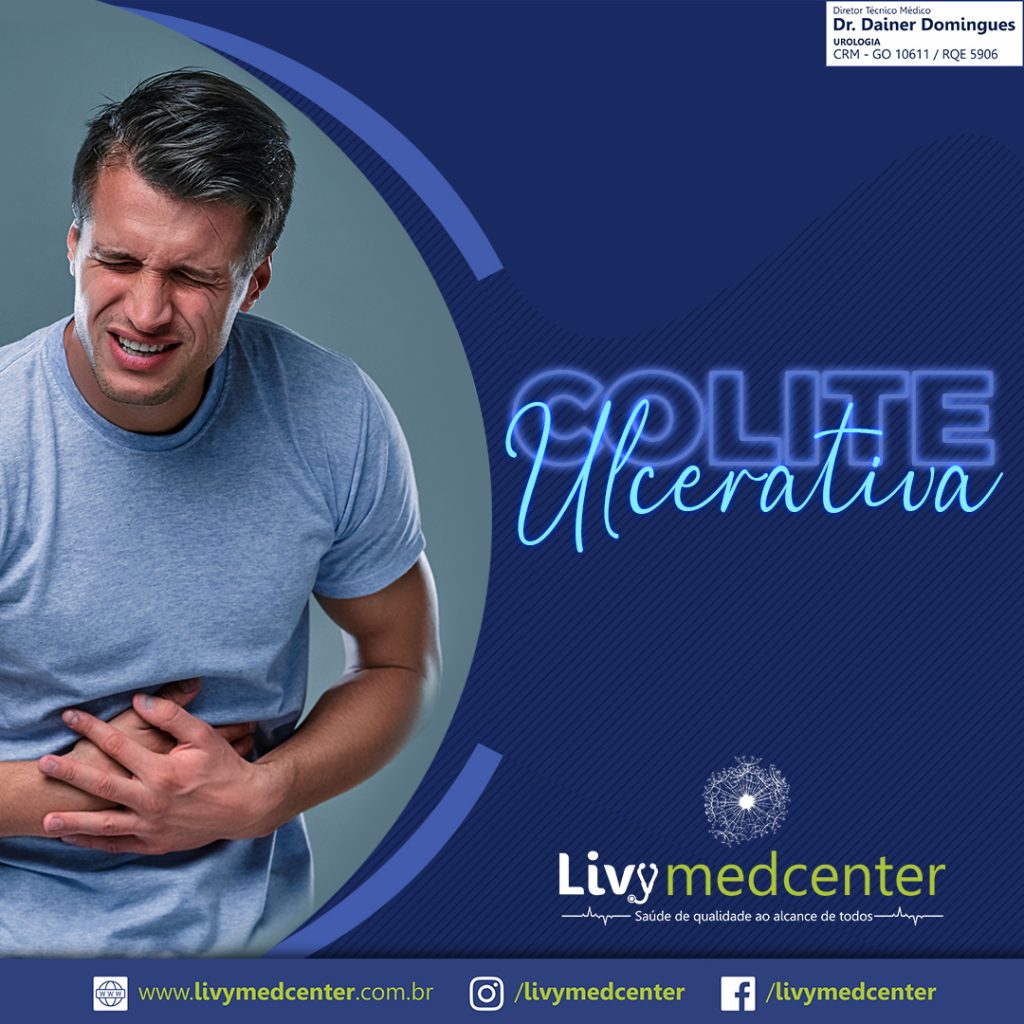 Colite Ulcerativa