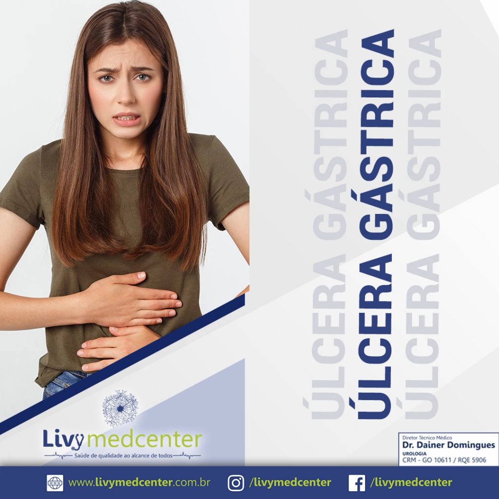 Úlcera Gástrica