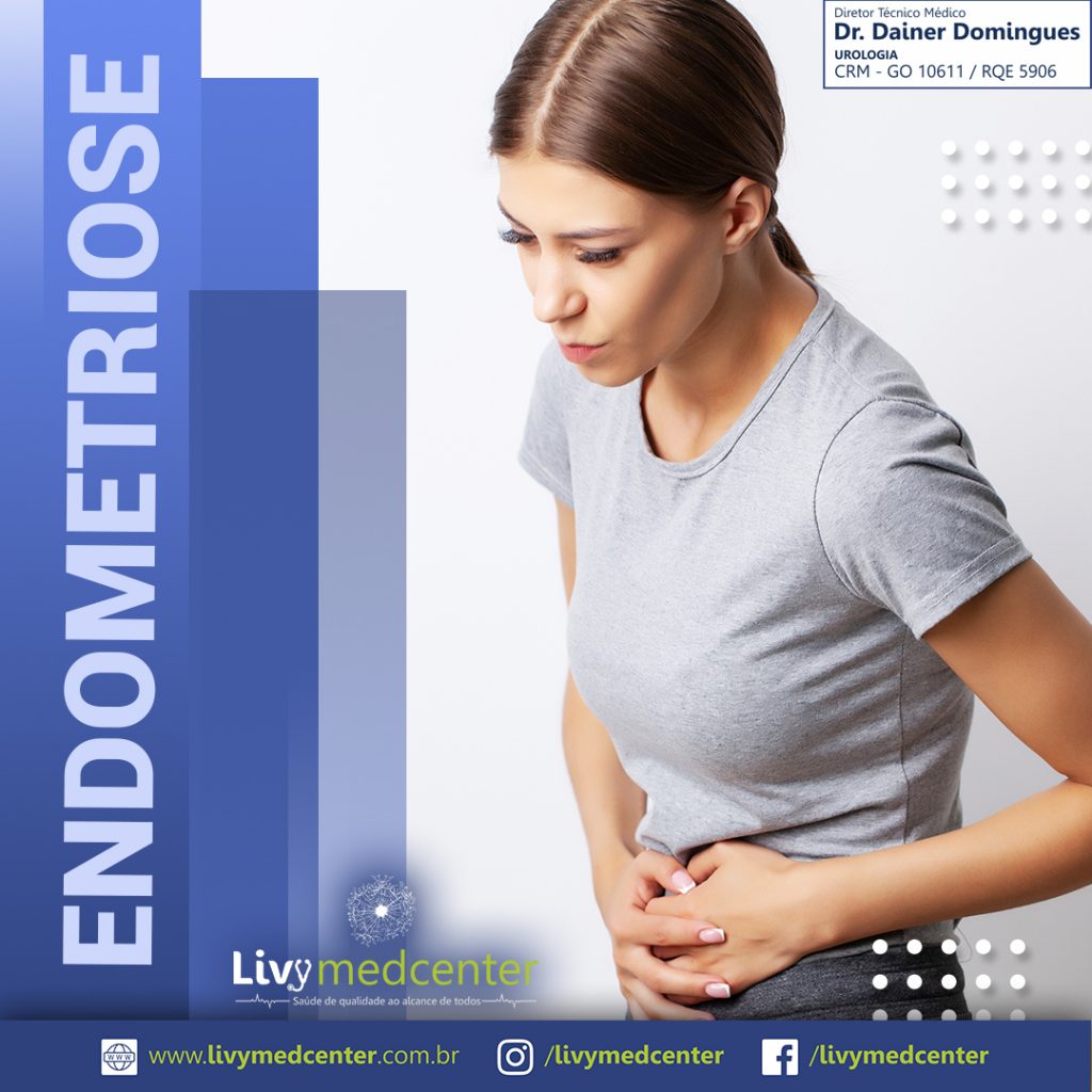 ENDOMETRIOSE