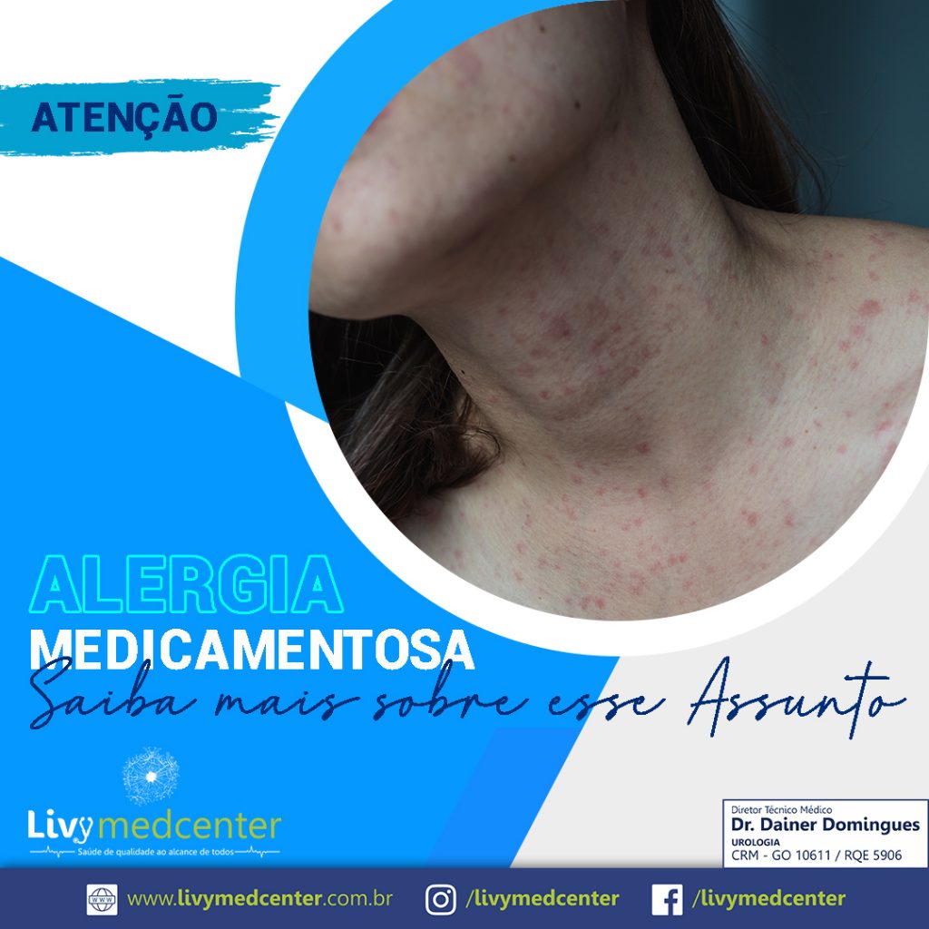 Alergia Medicamentosa