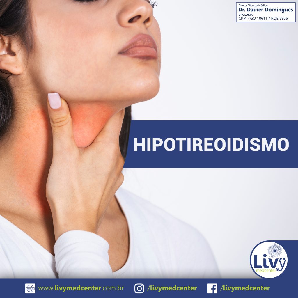 Hipotireoidismo