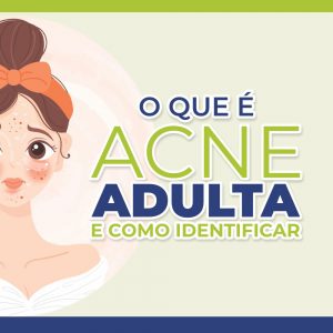 O que é ACNE adulta e como identificar