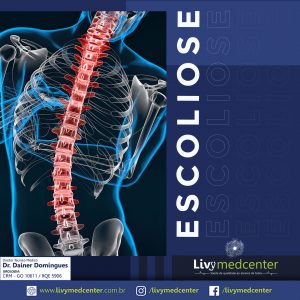 Escoliose