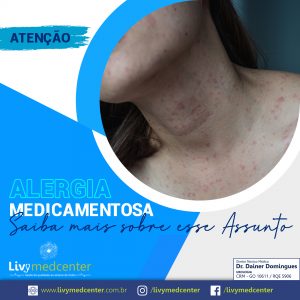 Alergia Medicamentosa